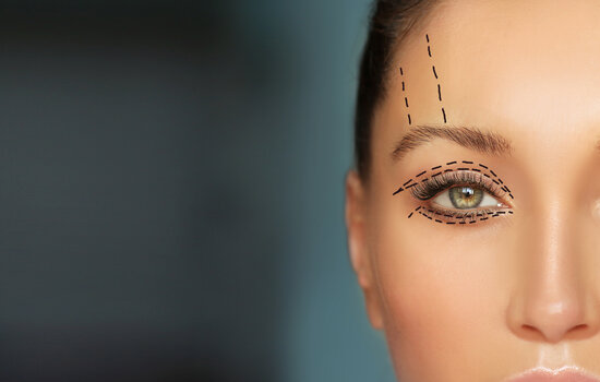 Mediguide Istanbul Plastic Surgery: Eye Surgery Procedures