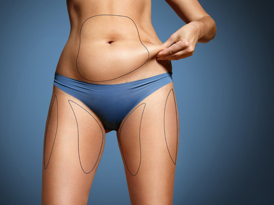 Mediguide Istanbul: Body Contouring - Liposuction and Laser Lipolysis