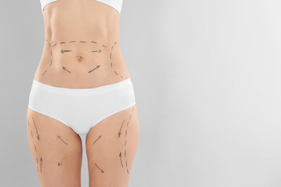 Mediguide Istanbul: Body Contouring - Mummy Makeover
