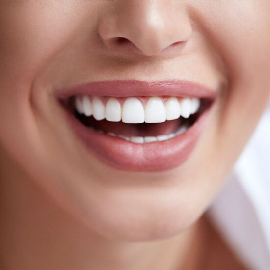 Mediguide Istanbul: Dental Procedures - Smile Makeover