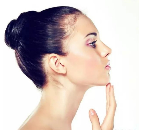 Mediguide Istanbul: Face Contouring - Chin Advancement